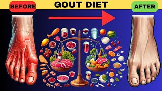 Optimal Nutrition for Gout Relief Top Foods to Include in Your Gout Diet [upl. by Jacobina]