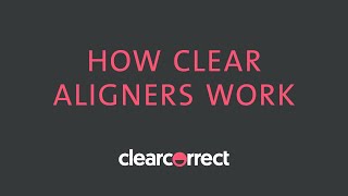 How clear aligners work [upl. by Notyal]