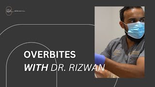 Why You Should Fix An Overbite With Dr Rizwan [upl. by Raphael98]