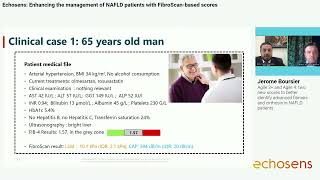 FibroScan®based Scores in NAFLD patient management [upl. by Sihonn338]