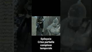 Epilepsie  crise partielle Complexe temporale [upl. by Cott]