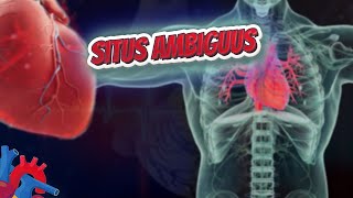 Situs ambiguus  Human Heart ❤️ and Cardiology ❤️🔊✅ [upl. by Kin]