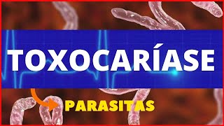 TOXOCARÍASE TOXOCARA CANIS  PARASITOLOGIA  INFECTOLOGIA  TUDO SOBRE TOXOCARÍASE [upl. by Fahy658]