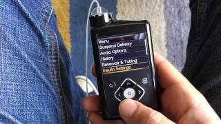 Medtronic MiniMed 640G insulin pump  What is SmartGuard [upl. by Cuthbert]