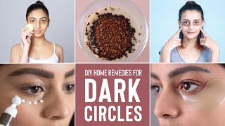 How To Get Rid Of DARK CIRCLES Naturally amp Effectively  Home Remedies amp DIY Masks [upl. by Okiron]