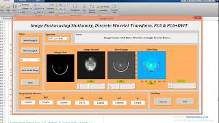 MATLAB code of Medical Image Fusion in Dicom format [upl. by Nediarb]