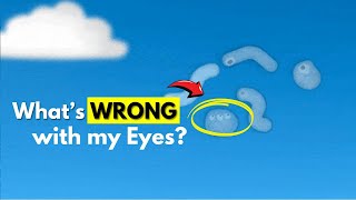 What are those floating things in your eyes  Eye Floaters Explained [upl. by Acinna979]