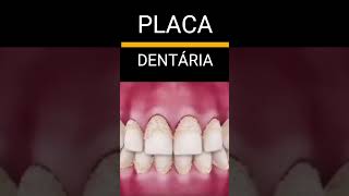 PELÍCULA ADQUIRIDA X PLACA DENTAL shorts shortfeed shortvideo odonto odontologia calculodental [upl. by Anallise926]