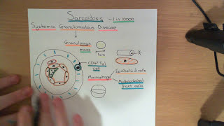 Sarcoidosis Part 1 [upl. by Barrus913]