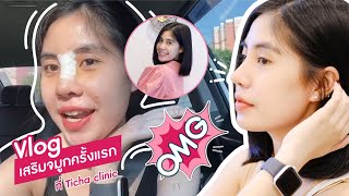 Vlog เสริมจมูกครั้งแรกของมิลค์ที่ Ticha Clinic [upl. by Noillimaxam]