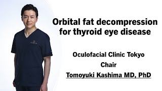 Orbital FAT decompression for thyroid eye disease Oculofacial Clinic Tokyo [upl. by Nirrol]