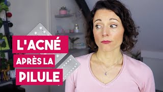 Comment gérer lacné hormonale après larrêt de la pilule [upl. by Salba421]