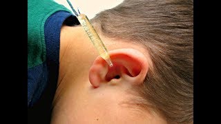 EARACHE GONE in 15 MINUTES using these 3 HOUSEHOLD INGREDIENTS [upl. by Groot]