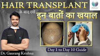 How to Spend the First 10 Days After Hair Transplant  Precautions after Hair Transplant  Medlinks [upl. by Ferwerda807]