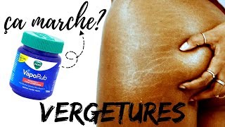 VERGETURES LA VÉRITÉ SUR LE VICKS VAPORUB [upl. by Farrell]