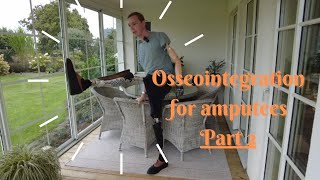 Benefits with osseointegration for amputees  Part 2 [upl. by Ellehctim984]