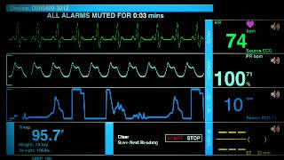 Sonido De Un Hospital [upl. by Manheim]