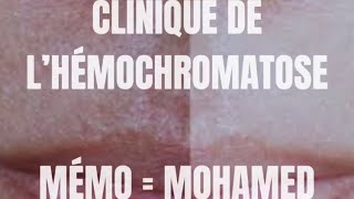 Mémo  Clinique de l’Hémochromatose [upl. by Stav727]