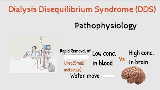 What is Dialysis Disequilibrium syndrome DDS  Hemodialysis Complications and management [upl. by Yarrum]