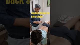 cupping therapy for back pain painreliefcenter physiotherapy cuppingtherapy [upl. by Lajet]