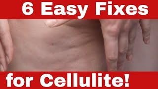 How to Get Rid of Cellulite Naturally  No Expensive Treatments [upl. by Mcnully291]