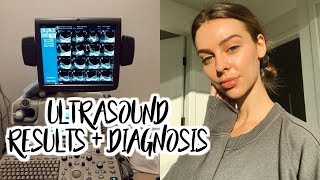 Ultrasound Results Diagnosis Health Updates My Plan [upl. by Atinuaj]