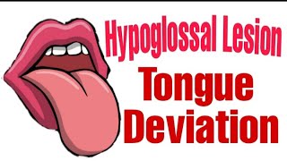 Hypoglossal Nerve Lesions  Tongue Deviation  UMN  LMN [upl. by Murdocca602]