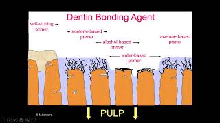 How to deal with current dentine adhesives Prof Ahmed Elmarakby [upl. by Eal]