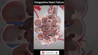 Congestive Heart Failure Explain 3DAnimation shorts [upl. by Ainoek796]