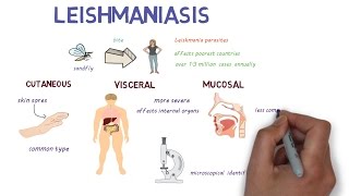 What is Leishmaniasis An introduction and overview [upl. by Riebling]