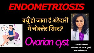 Endometriosis ovarian cyst why choclate cyst occur in ovaryMy Video [upl. by Kruter630]