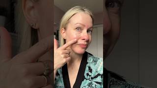 Using AZELAIC ACID for redness amp rosacea [upl. by Lorollas126]