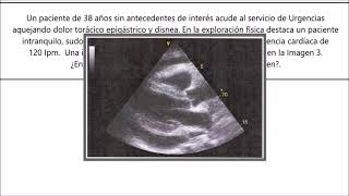 Preguntas IMPRESCINDIBLES de cardiología para el MIR [upl. by Hung]