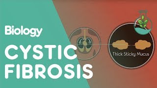 What Is Cystic Fibrosis  Health  Biology  FuseSchool [upl. by Busby111]