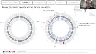 Multiomic Analysis Guides the Decisions of Brian McCloskey Rana McKay MD and BostonGene [upl. by Otrebireh829]