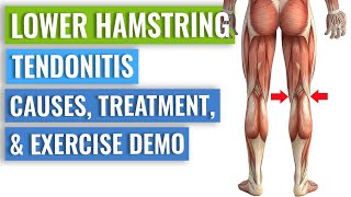 Three Simple Distal Hamstring Tendinopathy Exercises [upl. by Vaughn]