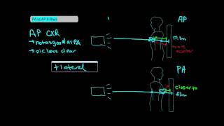 Types of Chest XRays part 1  AP vs PA UndergroundMed [upl. by Nyleahs180]