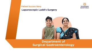 Laparoscopic Ladd’s Surgery  Yashoda Hospitals Hyderabad [upl. by Werra]