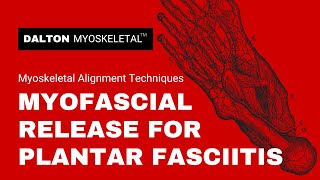 Use These Deep Tissue Myofascial Release Techniques for Plantar Fasciitis Treatment [upl. by Assinna255]