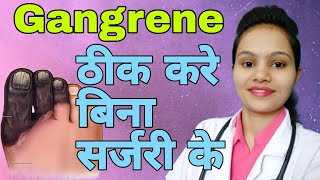 Top Best Homoeopathic medicine for Gangrene in hindi [upl. by Akemaj]