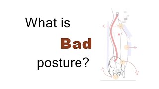 What is Bad Posture And why does it matter [upl. by Ylrebnik]