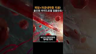 피임자궁내막증 치료 올인원 하이드로젤 임플란트 뉴스 과학 피임 [upl. by Hepsiba]