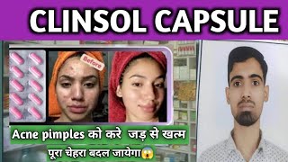 Clinsole Capsule acne पिंपल्स को ख़त्म करने की बेस्ट कैप्सूल जल्दी देखो सिर्फ 7 दिनों में 😱 acne [upl. by Anilrahc620]