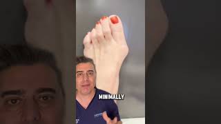 Unveiling the LifeChanging Procedure for Bunion Misery 😱 [upl. by Asseniv865]