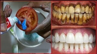 ✅ Truco Magico Para limpiar tus dientes en pocos minutos [upl. by Boak]