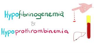 Hypofibrinogenemia and Hypoprothrombinemia [upl. by Koralle]