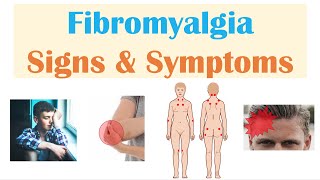 Fibromyalgia  Signs amp Symptoms Associated Conditions [upl. by Dewitt]