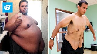 The Incredible Shrinking Man  Jesse Shand Lost 350 Pounds [upl. by Susy781]