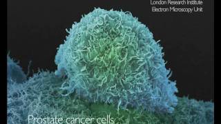 What Does Cancer Look Like  Cancer Research UK [upl. by Ecyoj]