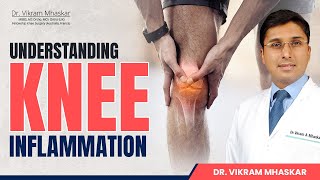 Understanding Knee Inflammation Causes amp Treatments  घुटनों की सूजन कारण   Dr Vikram Mhaskar [upl. by Keefe244]